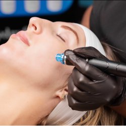 Bella Sole Wellness Spa - HydraFacial's unique system allows for a deep cleanse while simultaneously lavishing your skin in moisturizing antioxidants and botanicals.