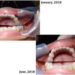 ECO Dental