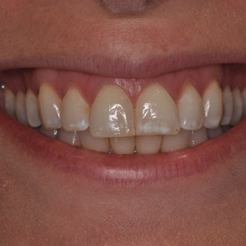 Blue Line Dental - Cosmetic Dentists Near Me - New York, New York