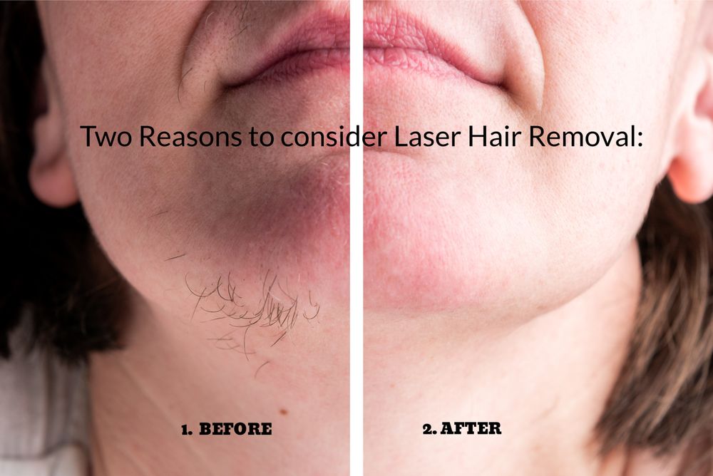 Laser Hair Solutions & Electrolysis Logo