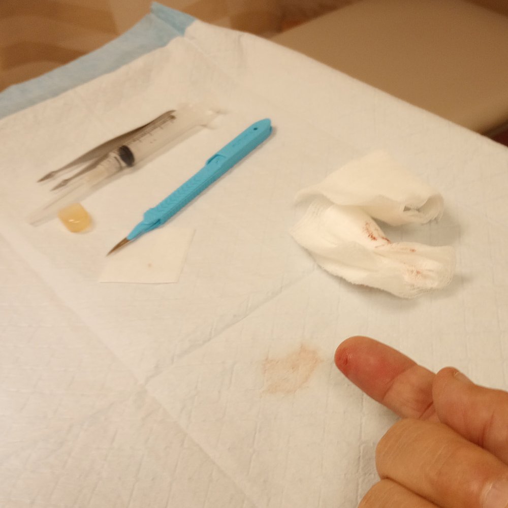 He called it a scalpel, but it was an exacto knife.