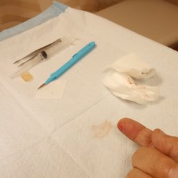 He called it a scalpel, but it was an exacto knife. He called it a scalpel, but it was an exacto knife.