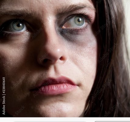 Dibbini Michael A DDS