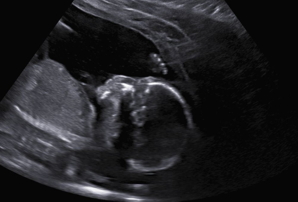 LITTLE BEE 3D PRENATAL IMAGING CENTER 13 Photos Landis, North