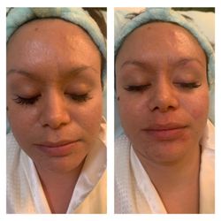 Bee You Body - Cleansing facial. Before and after. Hydrated beautiful clean skin!