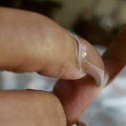Nails lifting in 3 days