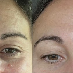 Glow to Go Facials - The results after a single facial is insane! My wrinkles disappeared.