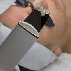 Luxury Skin OC - Extractions!
