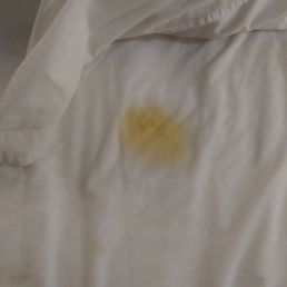 Stains