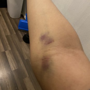 PCP for Life - Recently 4 days after blood taken - Medical Centers Near Me - Houston, Texas