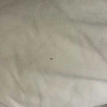 Econo Lodge - Bed bugs. - Hotels Near Me - Emporia, Kansas Econo Lodge - Bed bugs. - Hotels Near Me - Emporia, Kansas