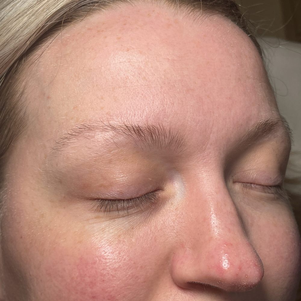 Before pic, very sparse eyebrow hairs and super light blonde Before pic, very sparse eyebrow hairs and super light blonde