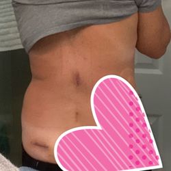 Damien Tavares, MD - My back is cured, no more pain, greatest doctor ever brought me back to life!!!!!