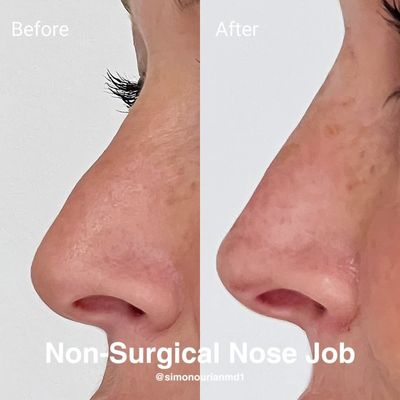 Simon Ourian, MD by null