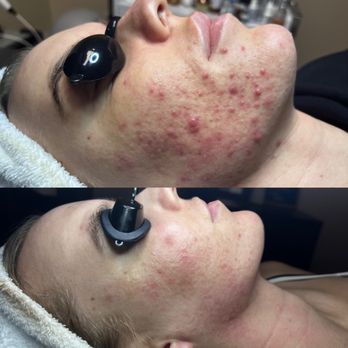 The Hyde Out - Estheticians Near Me - Claremont, California