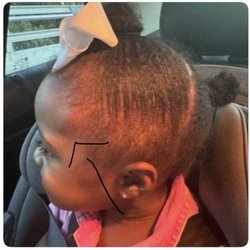 Galileo Montessori Academy - Citrus Park - Injury