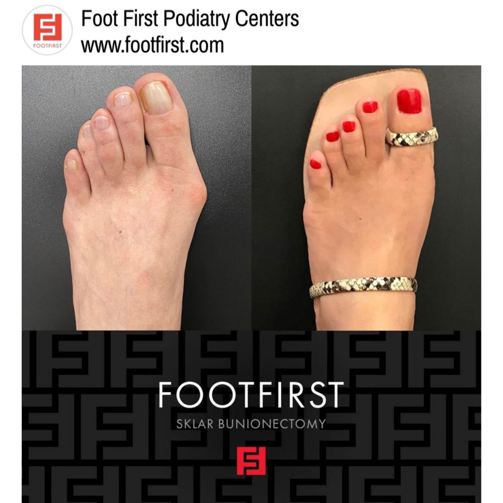 FOOT FIRST PODIATRY 171 Photos & 31 Reviews 1601 W Wise Rd