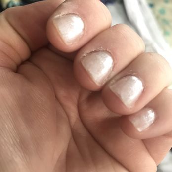 Spa Elysee - 3 hours after mani - Skin Care Near Me - Burlingame, California