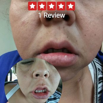 Melind Do DDS - And she still wanted to charge me $200and she didn't finish her job right and just burned my bottom gum and lip bad - General Dentistry Near Me - Anaheim, California Melind Do DDS - And she still wanted to charge me $200and she didn't finish her job right and just burned my bottom gum and lip bad - General Dentistry Near Me - Anaheim, California