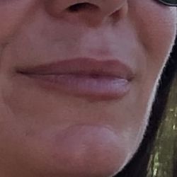 M Aesthetics of Orange County - Lips by Dr Munoz