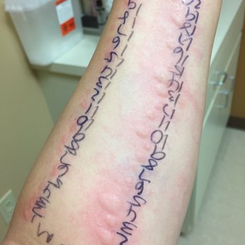 West Houston Allergy & Asthma - 75 prick skin test. Test for mold, trees, grass, ragweed, etc. - Allergists Near Me - Katy, Texas West Houston Allergy & Asthma - 75 prick skin test. Test for mold, trees, grass, ragweed, etc. - Allergists Near Me - Katy, Texas