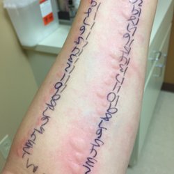 West Houston Allergy & Asthma - 75 prick skin test. Test for mold, trees, grass, ragweed, etc.