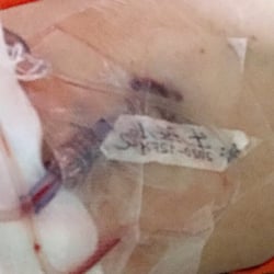 Banner Home Care - Thank you Banner Home Care for leaving this IV in this way and telling me it's my fault, again thank you.  I didn't put the IV in my arm.
