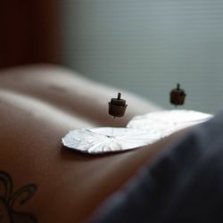 Lucky Tiger Acupuncture