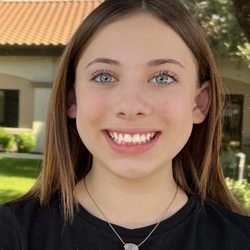 Sonoran Smile Orthodontics - Look at this gorgeous Sonoran Smile!