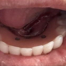Chandler Oral And Maxillofacial Surgery - My new teeth!