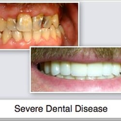 Warden Eglinton Dental Centre - See more before and after cases at http://wedental.ca/Gallery.html
