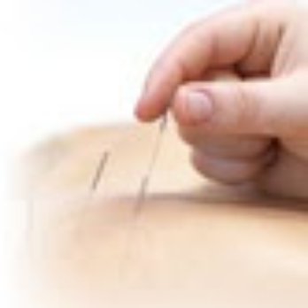Kitsilano Physiotherapy Clinic - Acupuncture - Physical Therapy Near Me - Vancouver, British Columbia Kitsilano Physiotherapy Clinic - Acupuncture - Physical Therapy Near Me - Vancouver, British Columbia