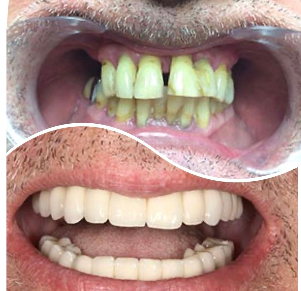 DENTAL ARTISTRY DUBLIN Dentists 63 North Strand Road Dublin 3