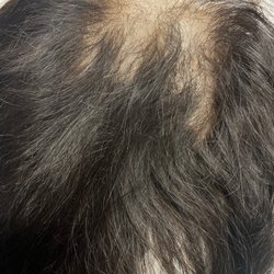 Star Kreations Salon - Here is a photo of the closure that was purchased from Star