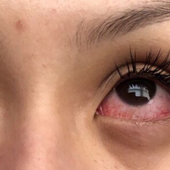 Chicago Lashes - Eyelash Service Near Me - Skokie, Illinois