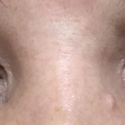 Permanent Makeup By Jennifer - Upper Liner After
