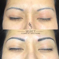 Select Cosmetic Solutions - Tattoo correction - microblading