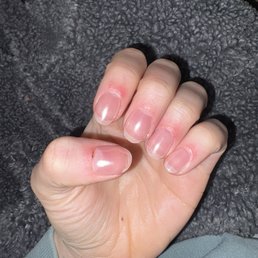 Bleeding & painful cuticles Bleeding & painful cuticles