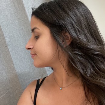 Evan Ransom, MD - Before my rhinoplasty procedure - Cosmetic Surgeons Near Me - San Francisco, California