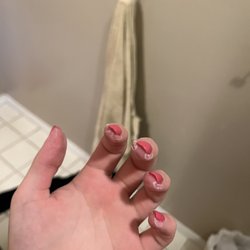 Fancy Nails & Spa - Skin around nails 5 days in
