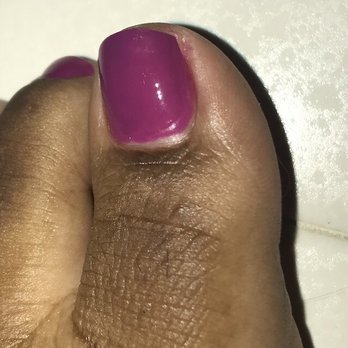 Infinity Spa and Nails - Hangnail was cut too far into my nail. - Nail Salons Near Me - Reston, Virginia Infinity Spa and Nails - Hangnail was cut too far into my nail. - Nail Salons Near Me - Reston, Virginia