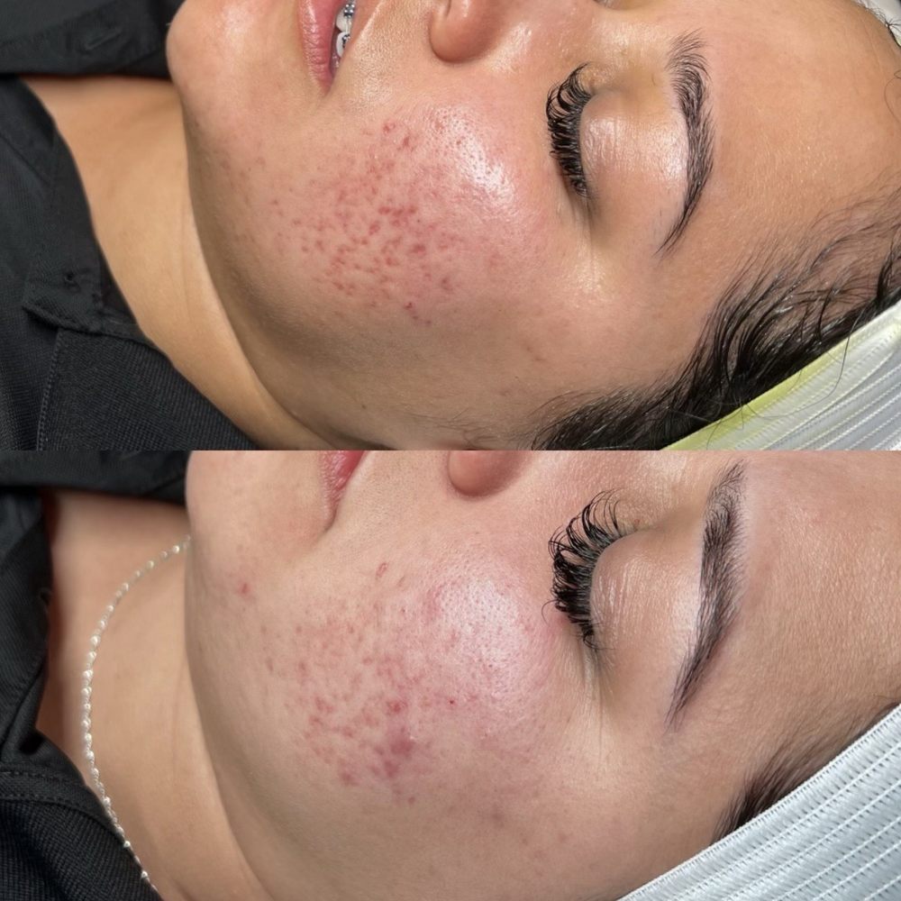 YS Aesthetics - It's getting better and better every time - Skin Care Near Me - Rancho Cucamonga, California YS Aesthetics - It's getting better and better every time - Skin Care Near Me - Rancho Cucamonga, California