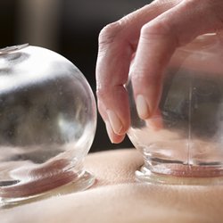 Lee's Herbs Acupuncture - Cupping therapy is good for expell wind, relieve pain, relax, regulatie energy.  Many Atheletes like it because it's for energy and pain