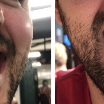 Midtown Dental Group  - Before and after - General Dentistry Near Me - New York, New York