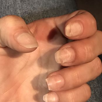 Friendly Nails & Spa - .A fungus on middle finger she tried to grind off and this is how she left my nail shaped. - Nail Salons Near Me - Holiday, Florida