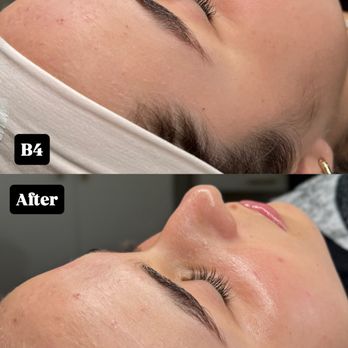 1 Z 1 By Melz - Skin Care Near Me - Homestead, Florida 1 Z 1 By Melz - Skin Care Near Me - Homestead, Florida