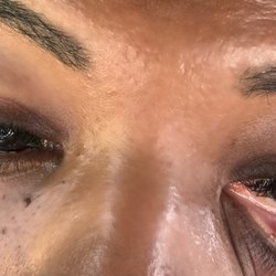 Amazing Lash Studio - Right eye-pink eye, left eye stye.