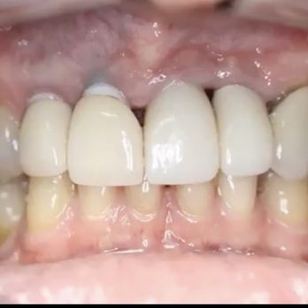 Mount Zion Dental - General Dentistry Near Me - North Miami Beach, Florida Mount Zion Dental - General Dentistry Near Me - North Miami Beach, Florida