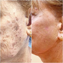 Angelika Aesthetics & Wellness