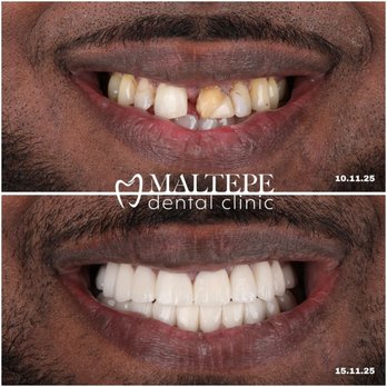 Maltepe Dental Clinic - Subtle work, strong impact. - General Dentistry Near Me - Istanbul, 34